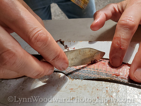 Lee-skin-snake-cell-LCWoodward-134012